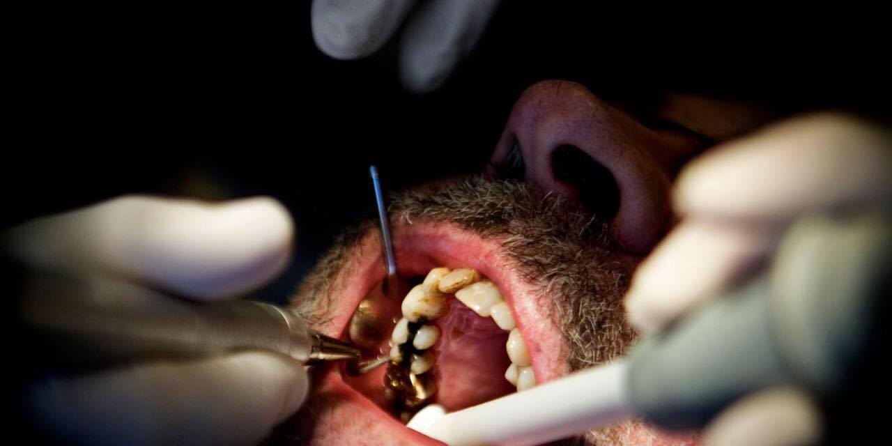 Tandlægebehandlinger til kriminelle koster skatteyderne 4,2 millioner kroner om året