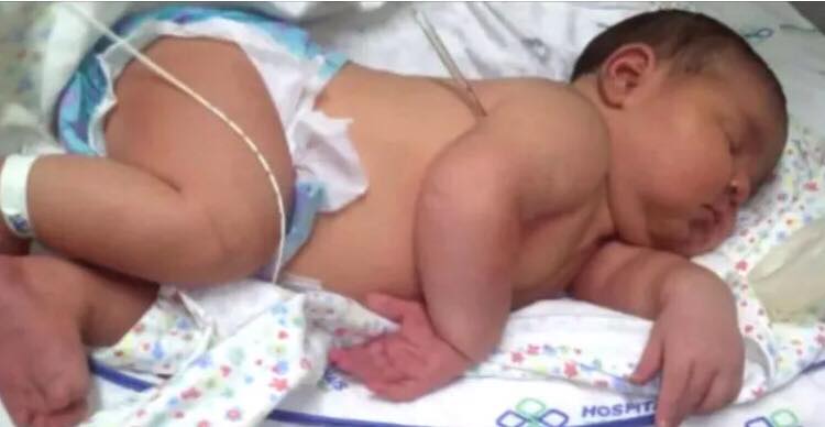 Nyfødt baby chokerer alle med rekordstørrelse på hospitalet