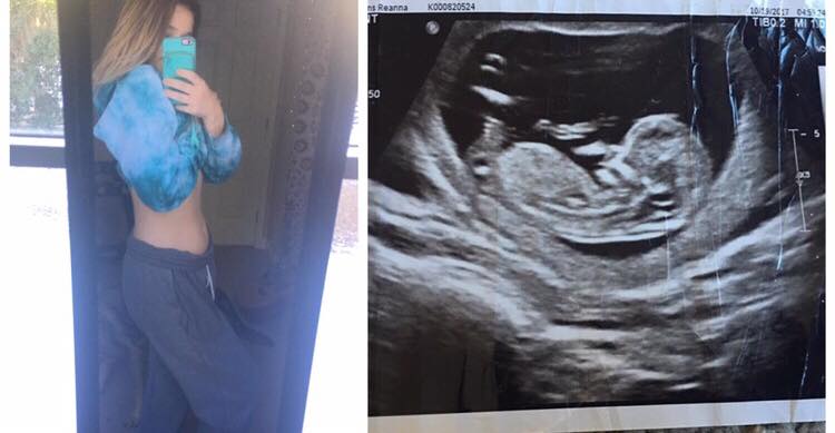 18-åriges graviditetsbilleder forvirrer nu internettet - ''er der overhovedet en baby derinde?''
