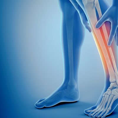3 effektive øvelser mod smerter i benene