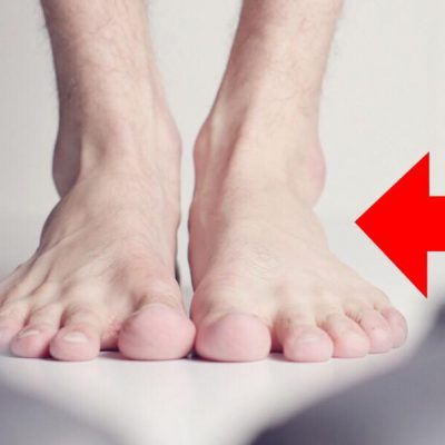 Tips og tricks: Sådan lindrer du smerter i hælen effektivt på en naturlig måde