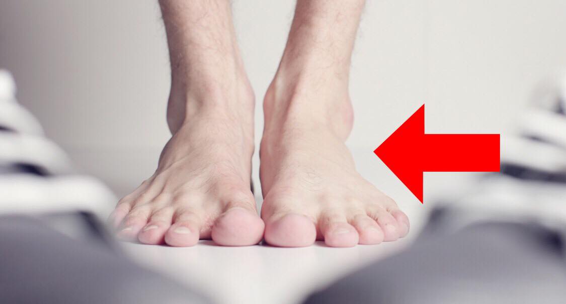 Tips og tricks: Sådan lindrer du smerter i hælen effektivt på en naturlig måde