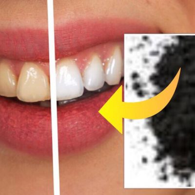 Sandt eller falsk: bliver dine tænder virkelig hvidere af aktivt kul?Sandt eller falsk: bliver dine tænder virkelig hvidere af aktivt kul?