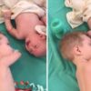 3-årig blev født uden arme – men se hvordan han trøster sin lillebror der græder ukontrolleret